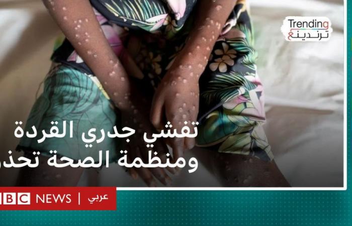 أخبار العالم : جدري القردة: منظمة الصحة العالمية تعلن حالة طوارئ صحية عالمية