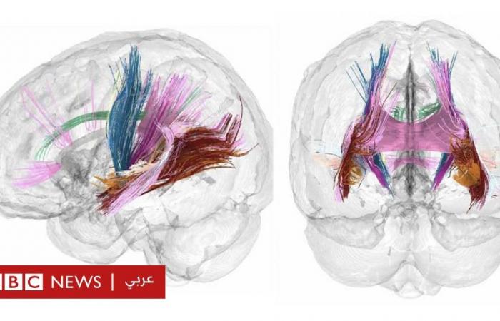 أخبار العالم : أشعة تفصيلية تكشف كيف يتغير دماغ المرأة أثناء الحمل